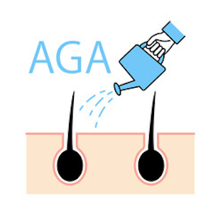 AGA治療