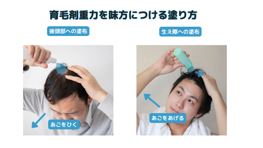 育毛剤重力を味方につける塗り方