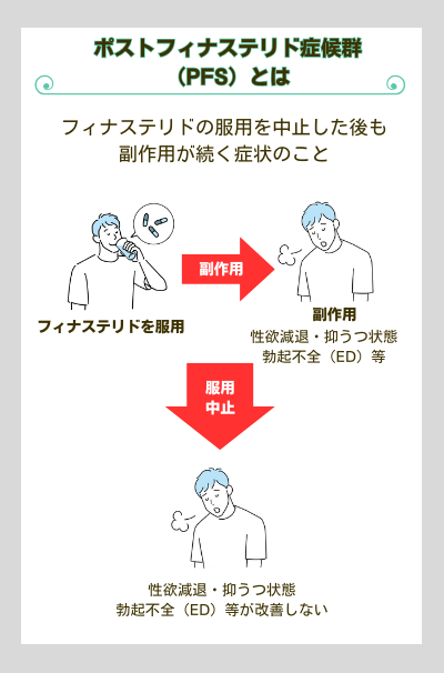 ポストフィナステリド症候群（PFS）とは